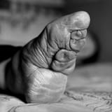 foot binding 
