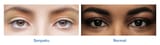 What_are_sanpaku_eyes_Image_3