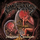 Malignancy Intrauterine Cannibalism