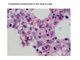 toxoplasma