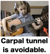 Carpal 