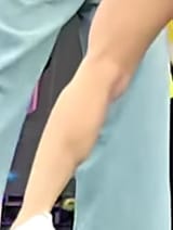 my arm looks like this