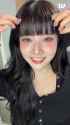 sieun forehead 1730670266457084_thumb.jpg