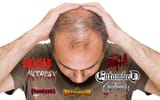 osdm baldcuck