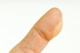 a-blister-on-a-finger