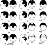 vegeta