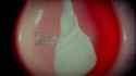 wony speculum_thumb.jpg