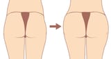 pelvic03_2