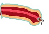 anti tick condom.jpg 