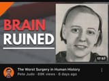 brain ruined (2)