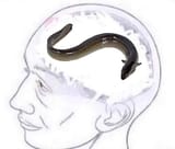 mentally eel