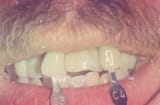 teeth3