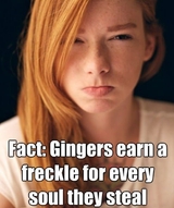 freckles