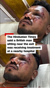Screenshot 2025-06-12 at 21-59-54 Passenger survives Air India plane crash
