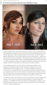248k in trans surgeries