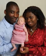 nigerian albino baby