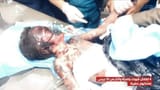 yemen-missile-strike
