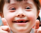 trisomy21