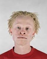 Mar06-albino_african_americans