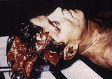 JFK_autopsy