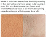 skin