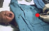 male genital mutilation