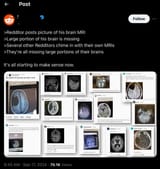 frontal_cortex_deficiency_AKA_atheism_reddit1742050063839194