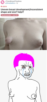 transbreast