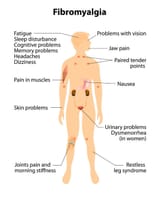 fibromyalgia_symptoms39548220_M