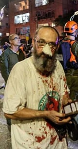 JewNoseBombed