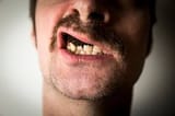 snus