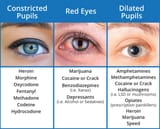 Pupil-Dialation-Drug-Chart-746x600