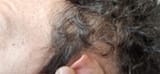 mipelo