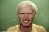 Indian albino