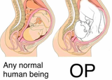 OPinWomb