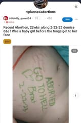 1749398142140557