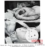 MIX-Victims-of-World-War-II-2-11