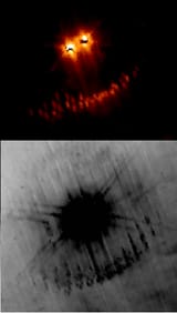 eye