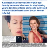 celebrities use foreskin stem cell