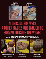 dc-late-term-aborted-babies-infanticide
