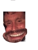 tds trs mike grin veneers