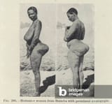 bixnood