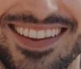4556
