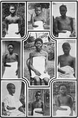 MutilatedChildrenFromCongo