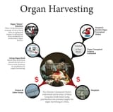 Chinese organ harvesting