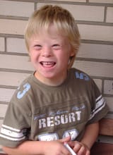 Boy_with_Down_Syndrome