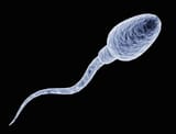 Screenshot 2025-06-18 at 17-42-58 sperm - Google Search