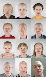 Anglin-Albino-Negro
