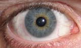 GreyEye