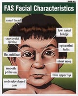48902d33ba17dcac3380f221c202481f--fetal-alcohol-syndrome-drinks-alcohol